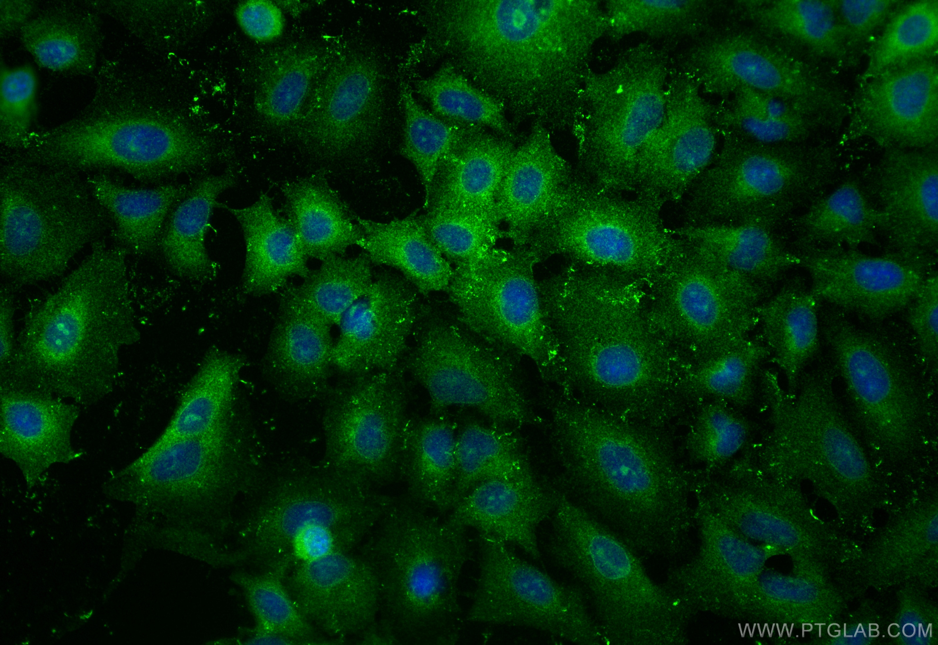 Immunofluorescence (IF) / fluorescent staining of A549 cells using NKCC1/SLC12A2 Polyclonal antibody (13884-1-AP)