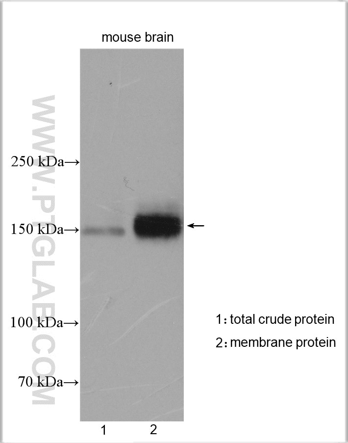 Western Blot (WB) analysis of various lysates using NKCC1,SLC12A2 Polyclonal antibody (13884-1-AP)