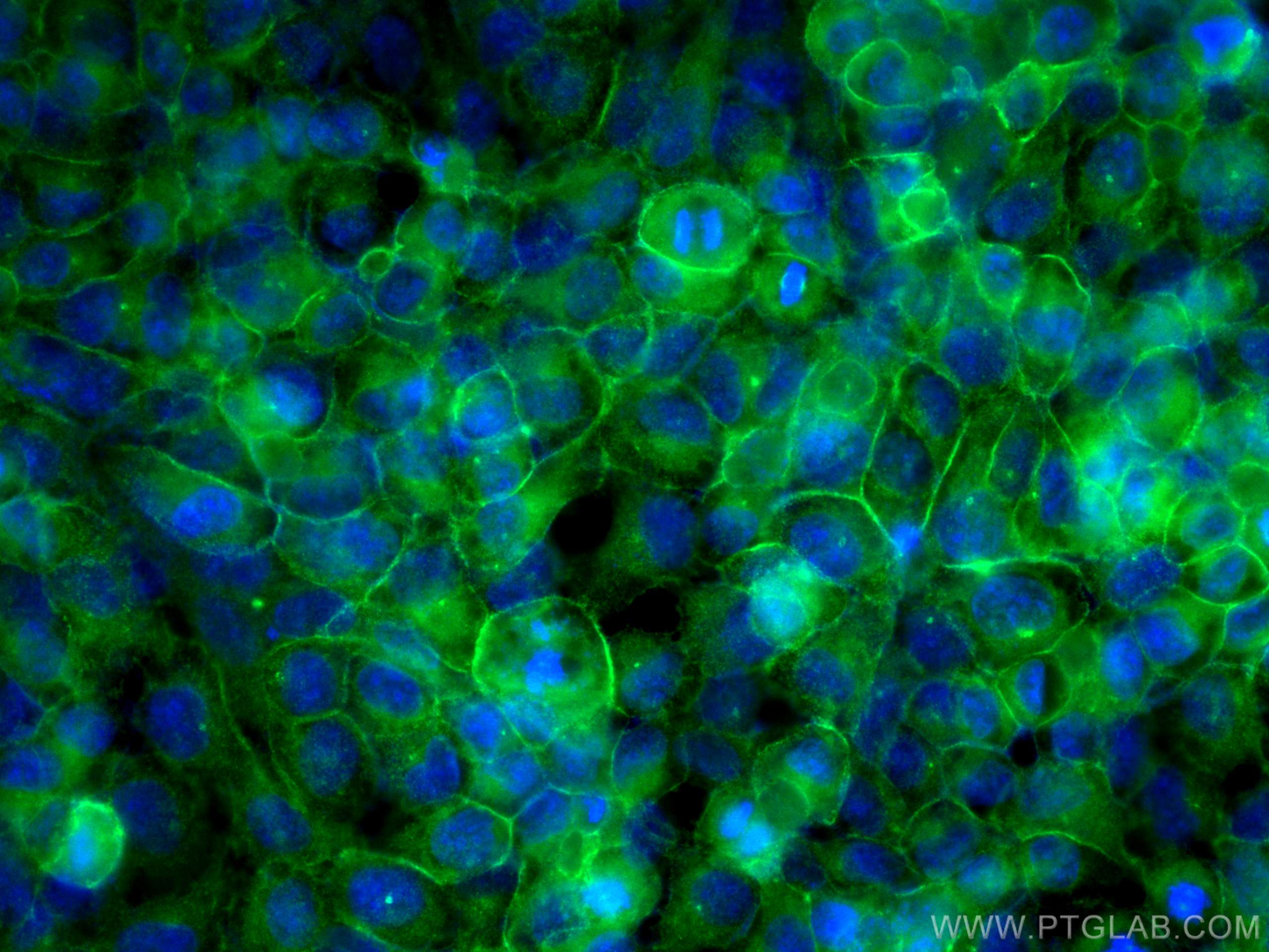 Immunofluorescence (IF) / fluorescent staining of HeLa cells using NKCC1,SLC12A2 Polyclonal antibody (28055-1-AP)