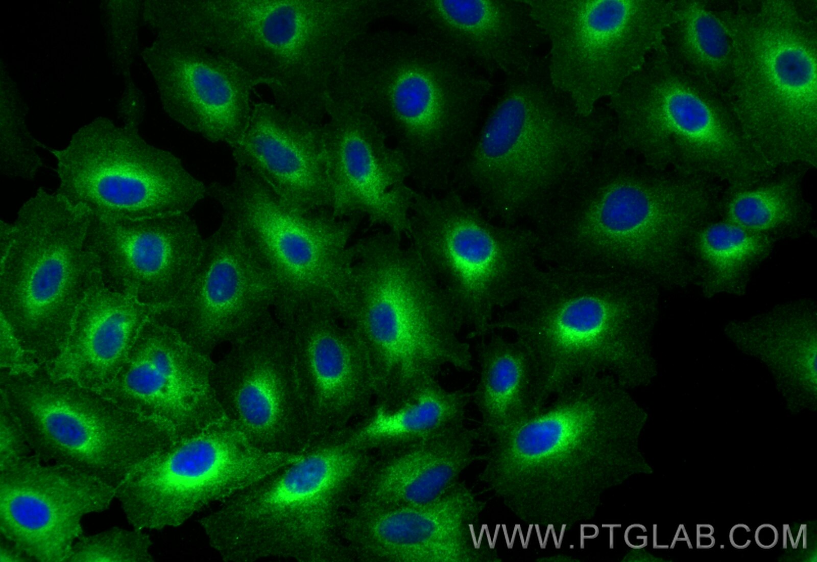 Immunofluorescence (IF) / fluorescent staining of A549 cells using NKCC1/SLC12A2 Polyclonal antibody (28055-1-AP)