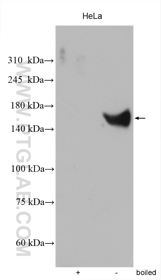 Western Blot (WB) analysis of various lysates using NKCC1,SLC12A2 Polyclonal antibody (28055-1-AP)