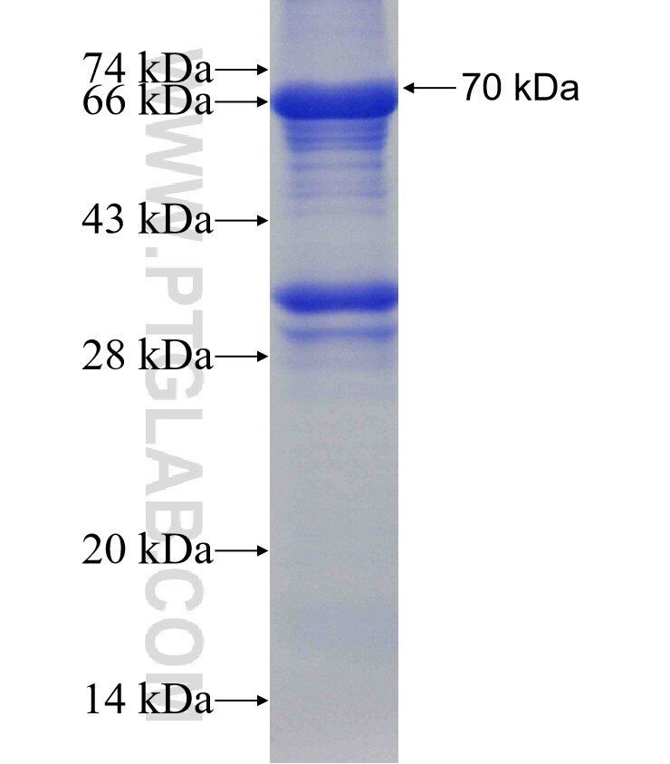 SLC12A2 fusion protein Ag4991 SDS-PAGE