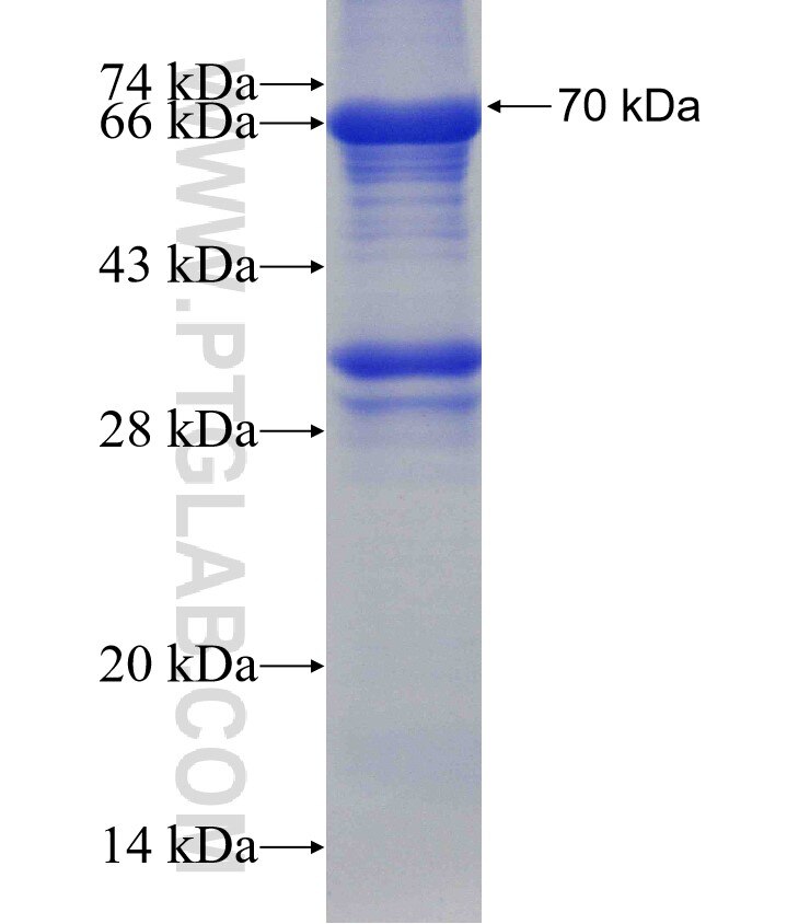 SLC12A2 fusion protein Ag4991 SDS-PAGE
