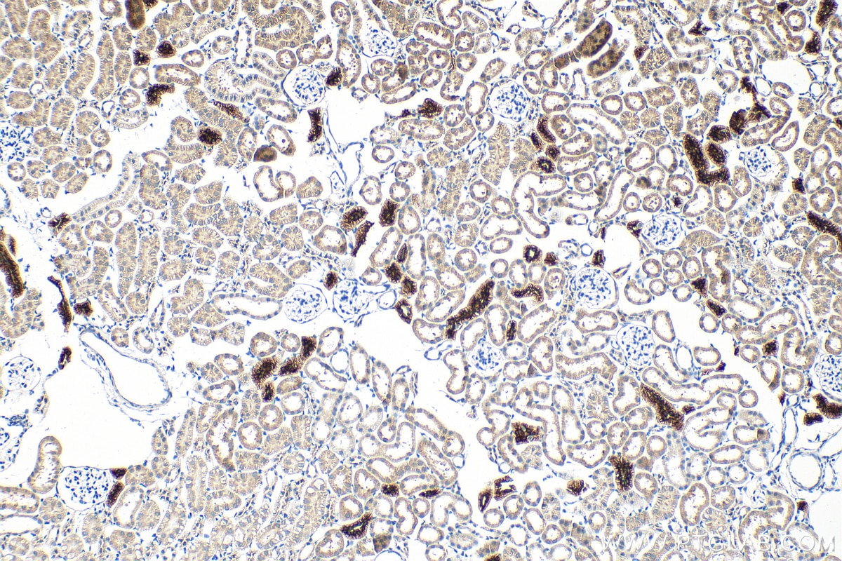 IHC staining of mouse kidney using 55442-1-AP Immunohistochemistry (IHC) staining of mouse kidney tissue using SLC12A3/NCCT Polyclonal antibody (55442-1-AP)