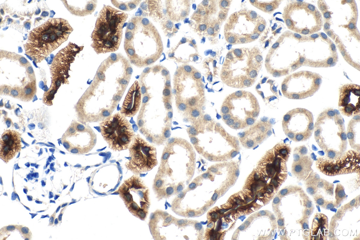 IHC staining of mouse kidney using 55442-1-AP Immunohistochemistry (IHC) staining of mouse kidney tissue using SLC12A3/NCCT Polyclonal antibody (55442-1-AP)