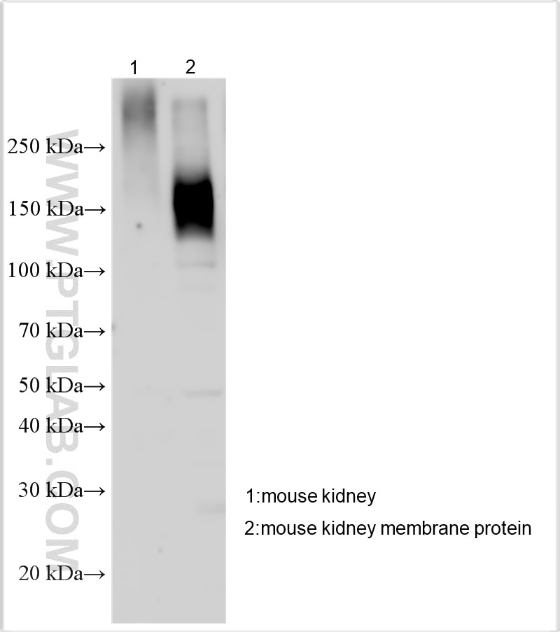 WB analysis using 55442-1-AP Western Blot (WB) analysis of various lysates using SLC12A3/NCCT Polyclonal antibody (55442-1-AP)