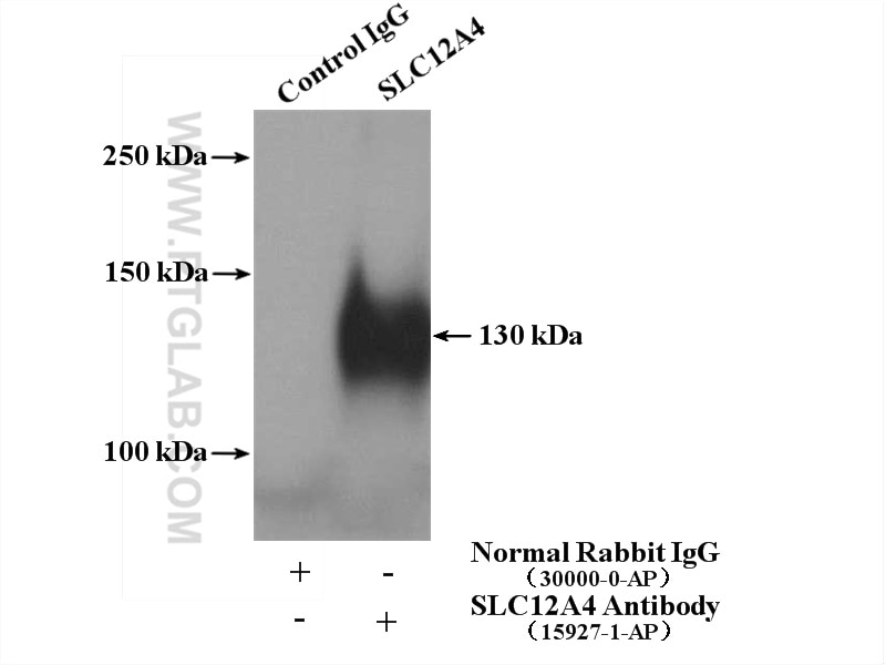 Immunoprecipitation (IP) experiment of HeLa cells using SLC12A4 Polyclonal antibody (15927-1-AP)