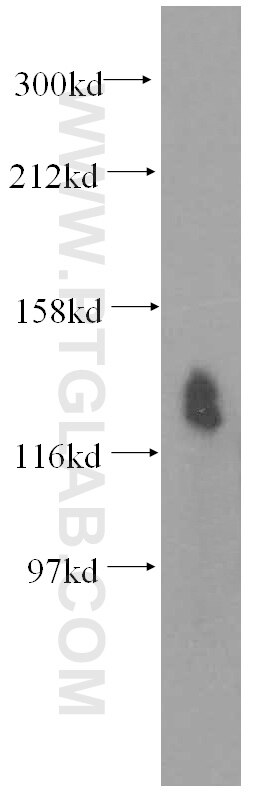 Western Blot (WB) analysis of HeLa cells using SLC12A4 Polyclonal antibody (15927-1-AP)