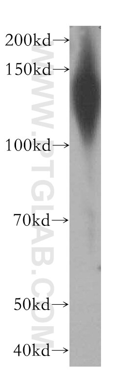 Western Blot (WB) analysis of HeLa cells using SLC12A4 Polyclonal antibody (15927-1-AP)