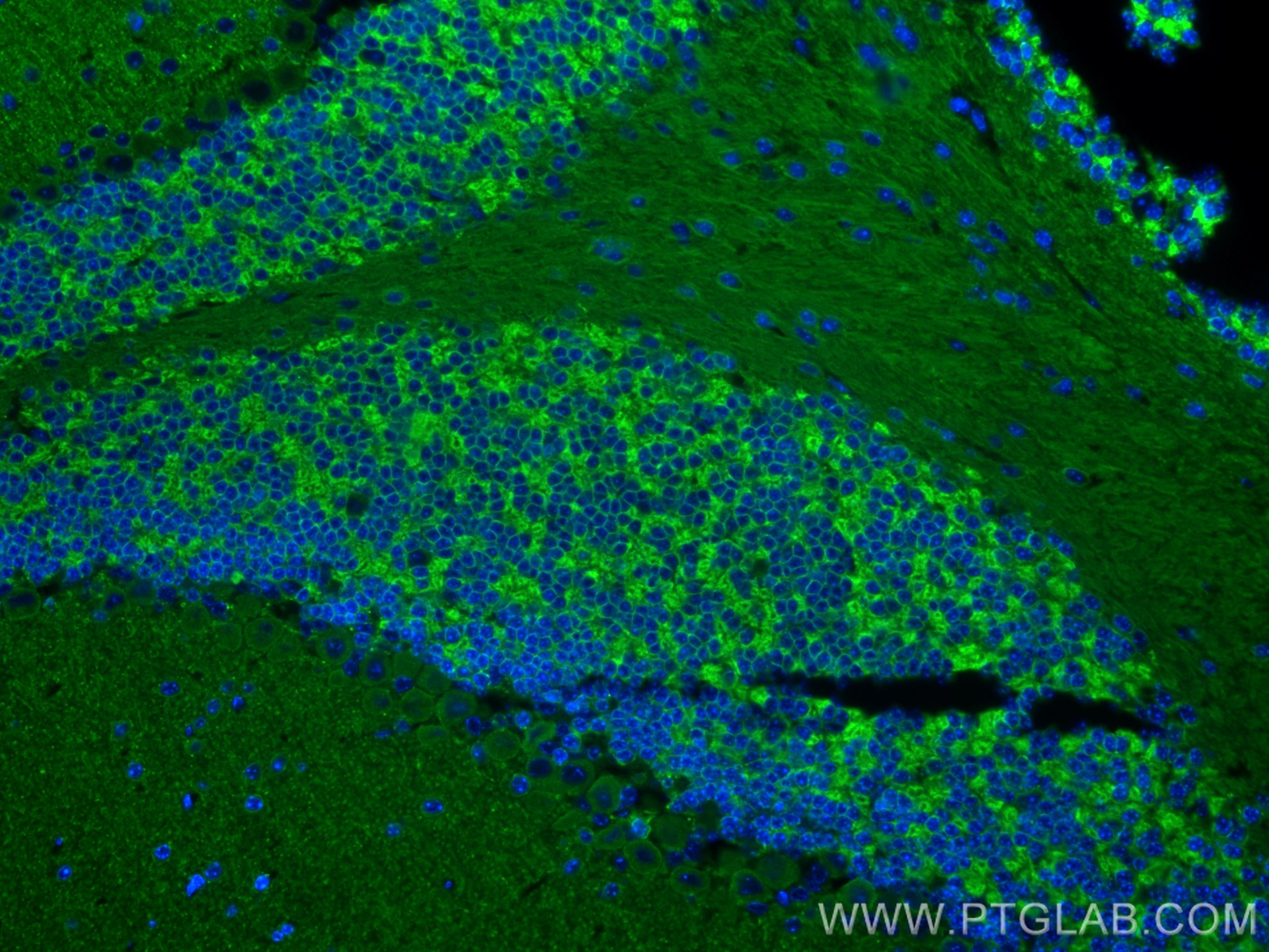 Immunofluorescence (IF) / fluorescent staining of mouse cerebellum tissue using KCC2/SLC12A5-Specific Polyclonal antibody (19565-1-AP)