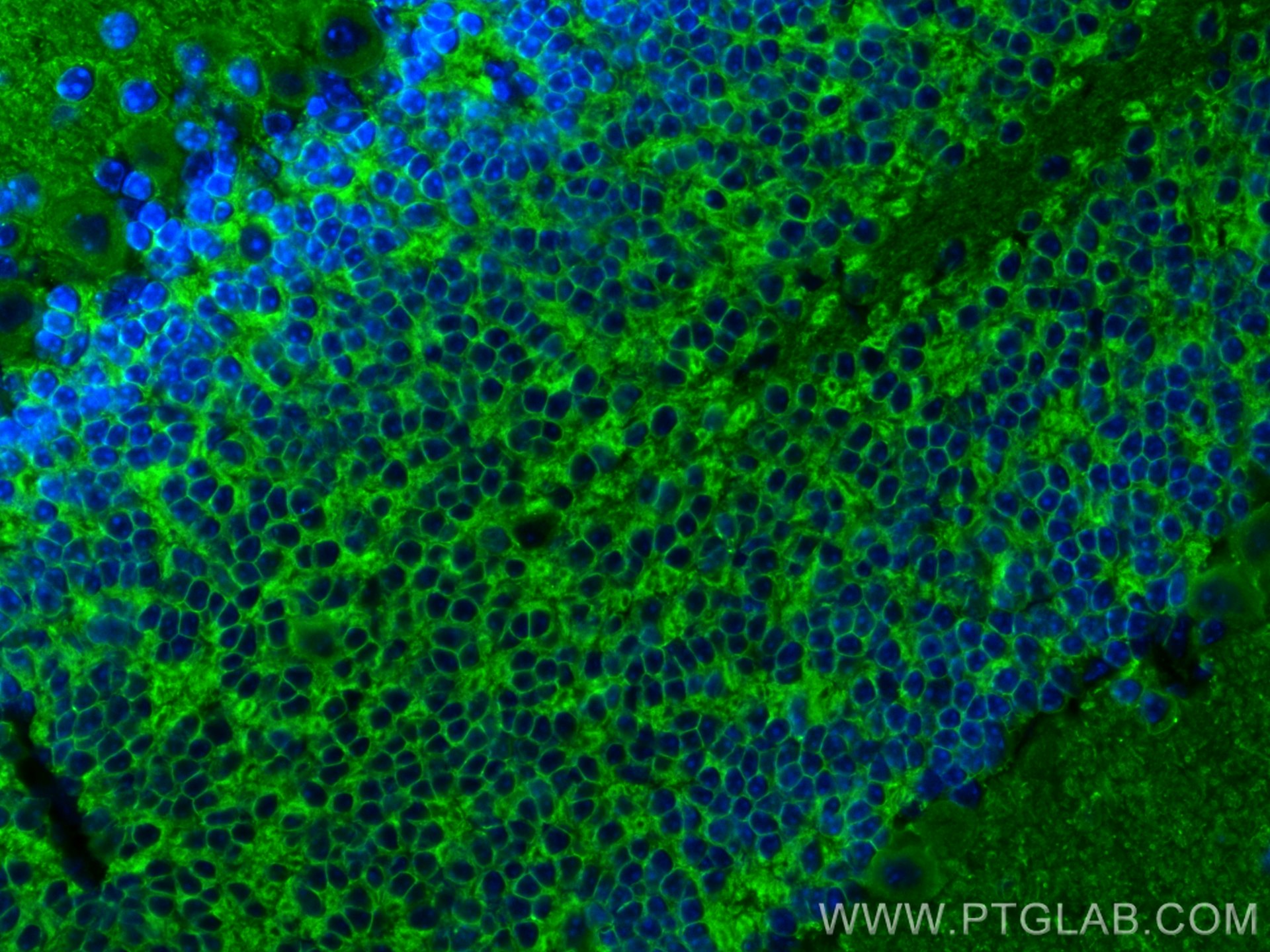 Immunofluorescence (IF) / fluorescent staining of mouse cerebellum tissue using KCC2/SLC12A5-Specific Polyclonal antibody (19565-1-AP)