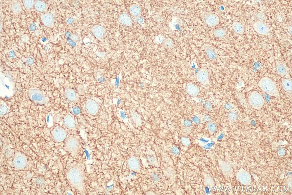 Immunohistochemistry (IHC) staining of rat brain tissue using KCC2/SLC12A5-Specific Polyclonal antibody (19565-1-AP)