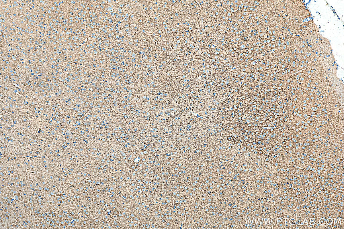 Immunohistochemistry (IHC) staining of mouse brain tissue using KCC2/SLC12A5-Specific Polyclonal antibody (19565-1-AP)