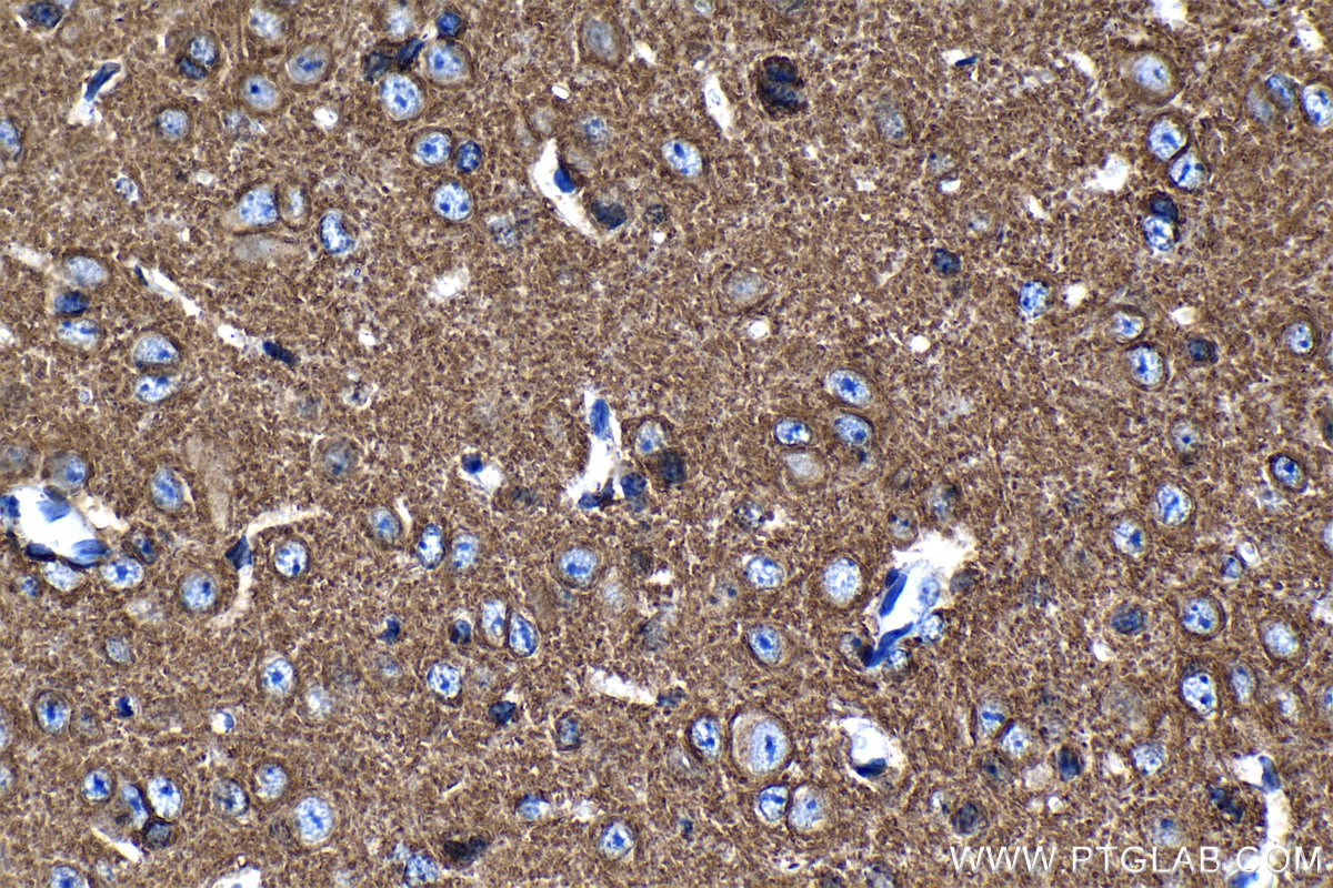Immunohistochemistry (IHC) staining of mouse cerebellum tissue using KCC2/SLC12A5-Specific Polyclonal antibody (19565-1-AP)