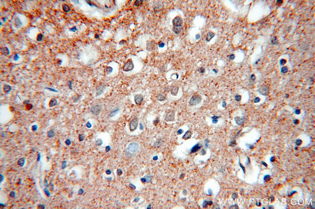 Immunohistochemistry (IHC) staining of human brain tissue using KCC2/SLC12A5-Specific Polyclonal antibody (19565-1-AP)