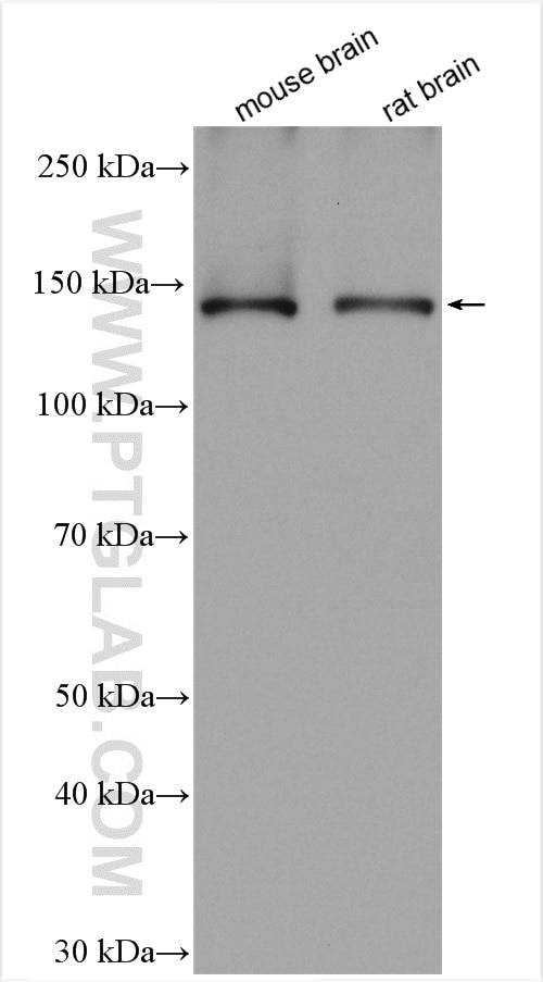 Western Blot (WB) analysis of various lysates using KCC2/SLC12A5-Specific Polyclonal antibody (19565-1-AP)