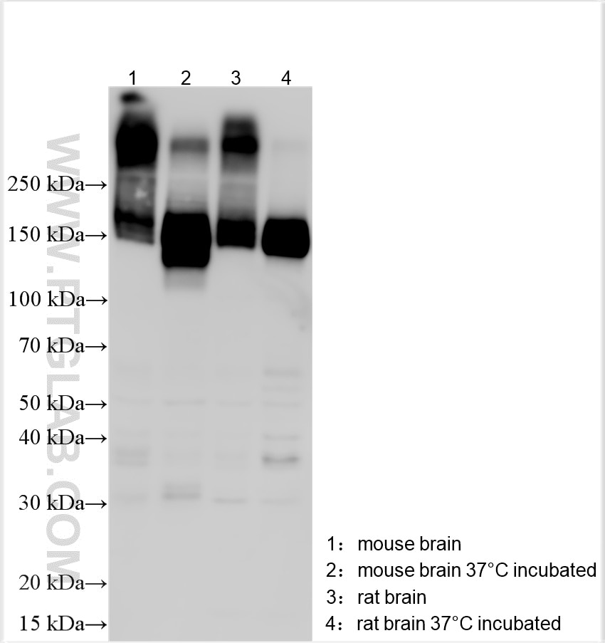Western Blot (WB) analysis of various lysates using KCC2/SLC12A5-Specific Polyclonal antibody (19565-1-AP)
