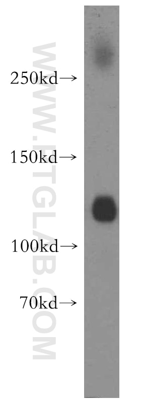 Western Blot (WB) analysis of human brain tissue using KCC2/SLC12A5-Specific Polyclonal antibody (19565-1-AP)