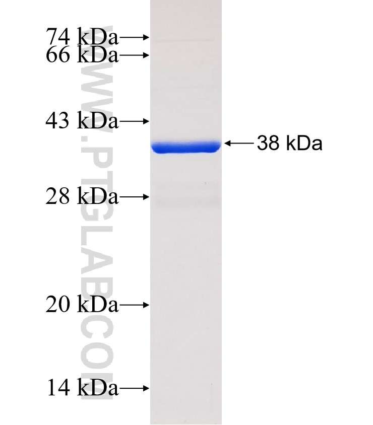 SLC12A6 fusion protein Ag31965 SDS-PAGE