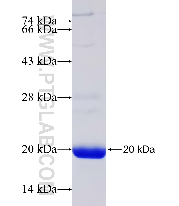 SLC12A6 fusion protein Ag31982 SDS-PAGE SLC12A6 fusion protein Ag31982 SDS-PAGE