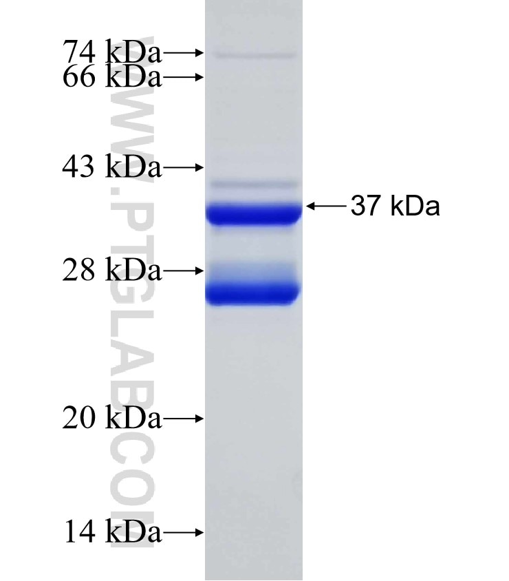 SLC12A9 fusion protein Ag25358 SDS-PAGE