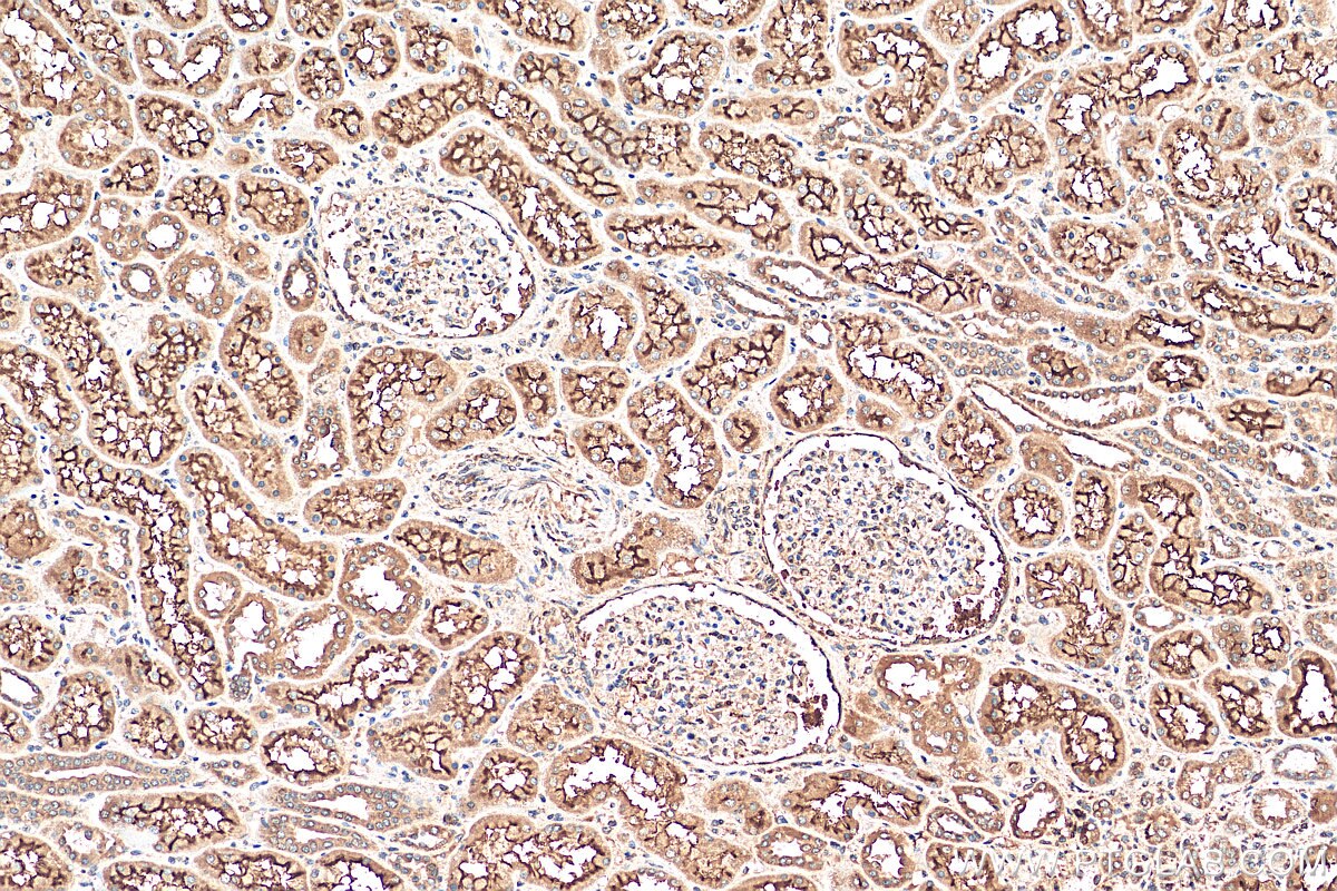 Immunohistochemistry (IHC) staining of human kidney tissue using SLC13A2 Polyclonal antibody (21722-1-AP)