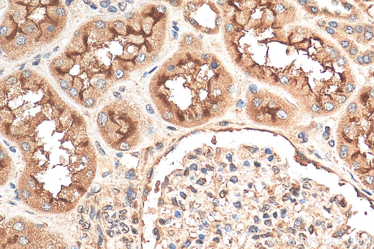 Immunohistochemistry (IHC) staining of human kidney tissue using SLC13A2 Polyclonal antibody (21722-1-AP)