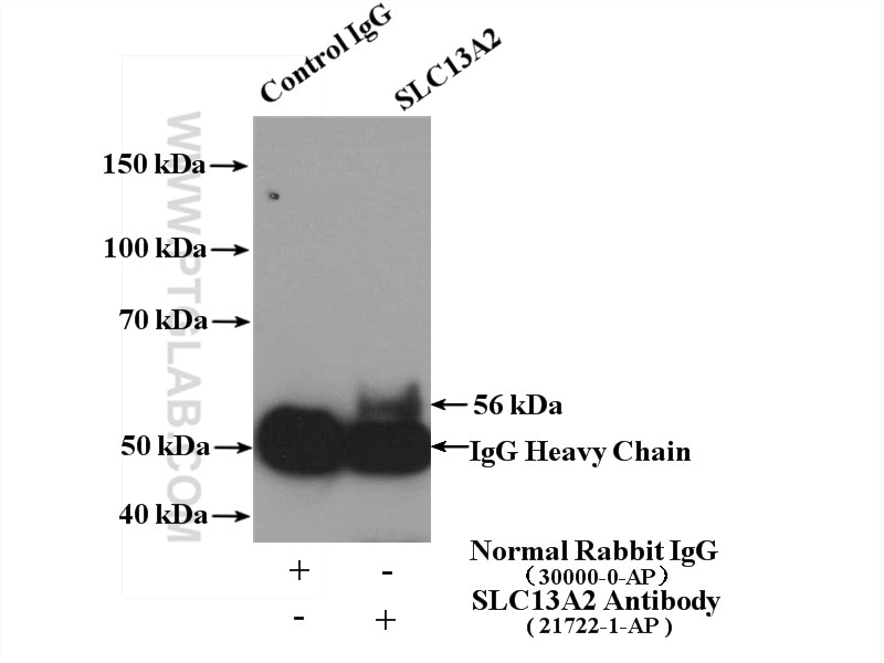 Immunoprecipitation (IP) experiment of mouse kidney tissue using SLC13A2 Polyclonal antibody (21722-1-AP)