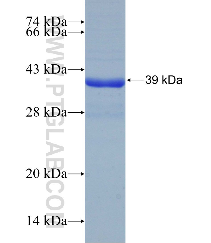 SLC13A2 fusion protein Ag16379 SDS-PAGE