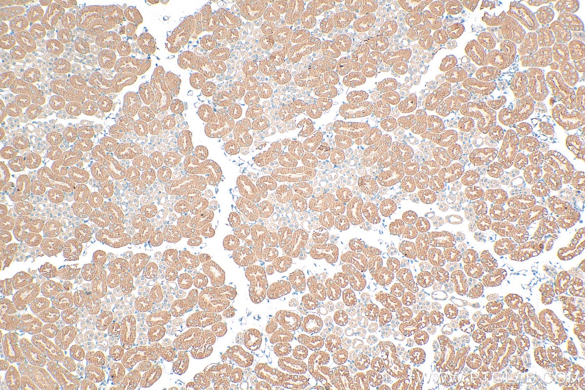 Immunohistochemistry (IHC) staining of mouse kidney tissue using SLC13A3 Polyclonal antibody (26182-1-AP)