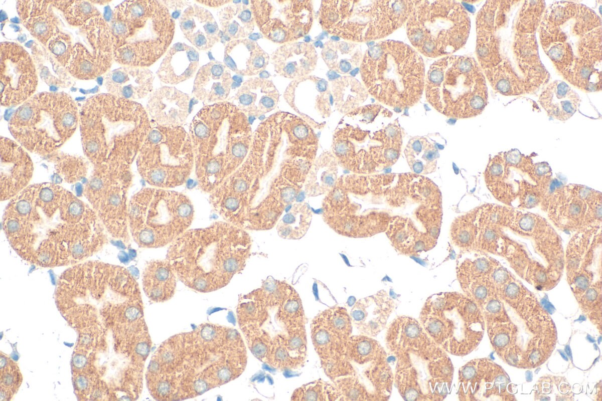Immunohistochemistry (IHC) staining of mouse kidney tissue using SLC13A3 Polyclonal antibody (26182-1-AP)