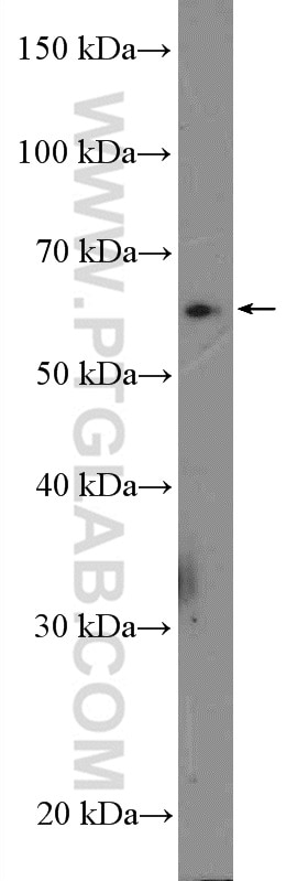 Western Blot (WB) analysis of HEK-293 cells using SLC13A3 Polyclonal antibody (26182-1-AP)