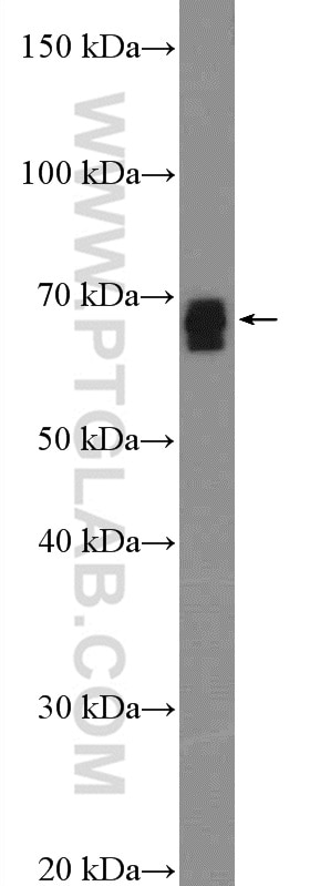 WB analysis of mouse kidney using 26182-1-AP