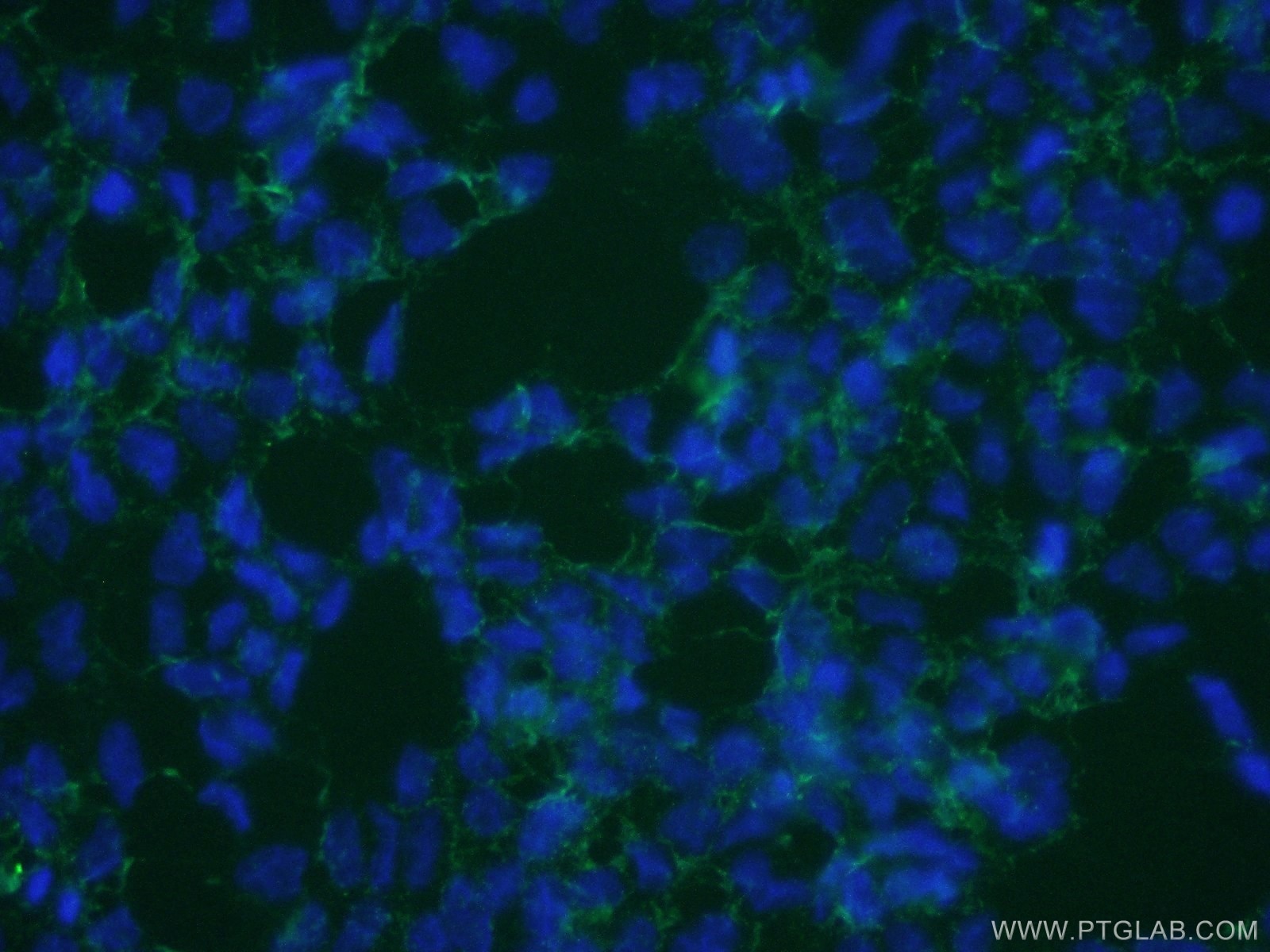 Immunofluorescence (IF) / fluorescent staining of HEK-293 cells using SLC13A4 Polyclonal antibody (20302-1-AP)