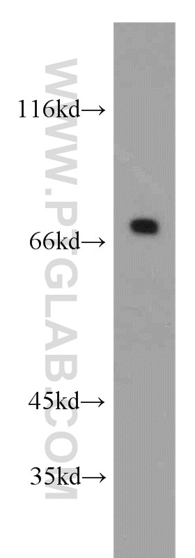 Western Blot (WB) analysis of HEK-293 cells using SLC13A4 Polyclonal antibody (20302-1-AP)