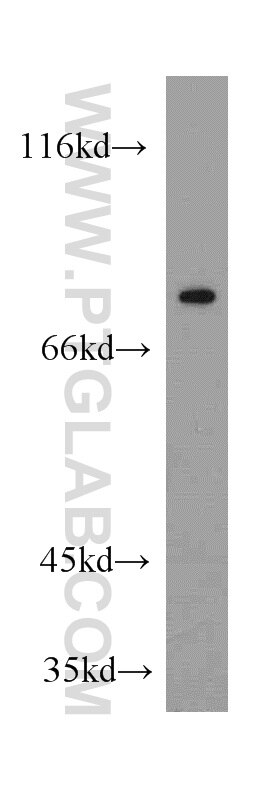 Western Blot (WB) analysis of HEK-293 cells using SLC13A4 Polyclonal antibody (20302-1-AP)