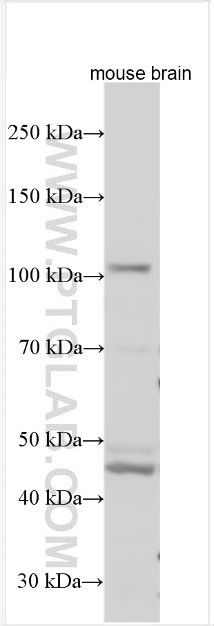 Western Blot (WB) analysis of various lysates using SLC14A2 Polyclonal antibody (21932-1-AP)