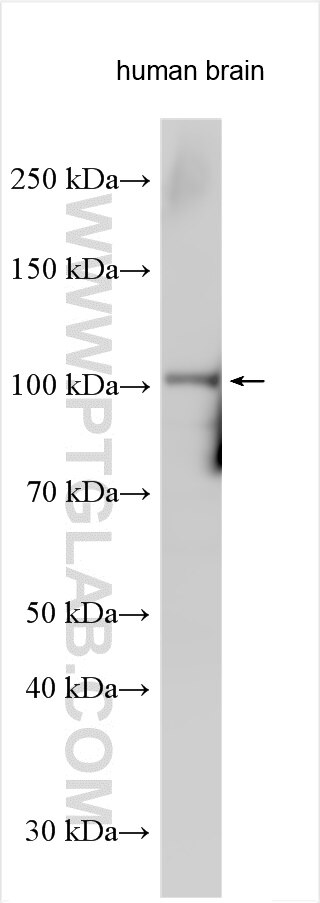 Western Blot (WB) analysis of various lysates using SLC14A2 Polyclonal antibody (21932-1-AP)