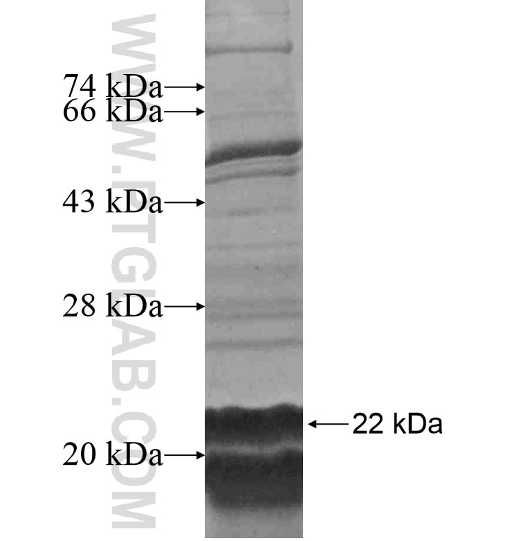 SLC14A2 fusion protein Ag16561 SDS-PAGE