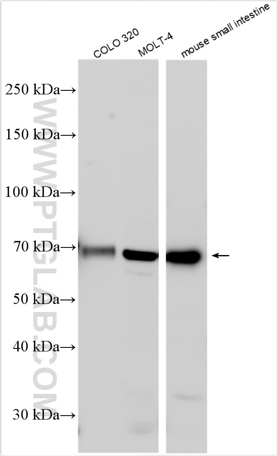 Western Blot (WB) analysis of various lysates using SLC15A1/PEPT1 Polyclonal antibody (21726-1-AP)