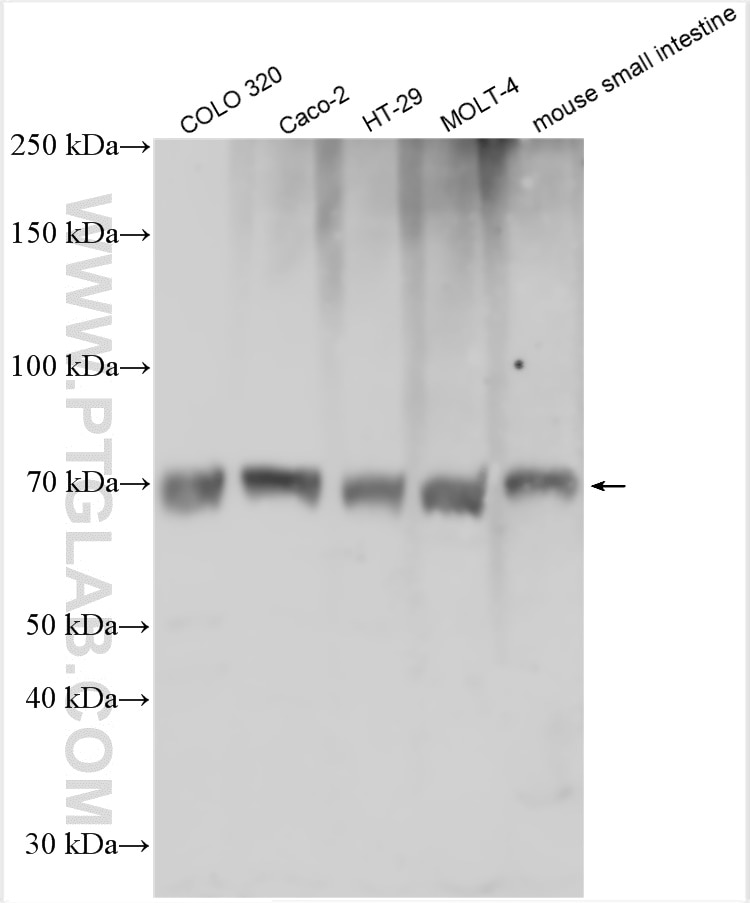 Western Blot (WB) analysis of various lysates using SLC15A1/PEPT1 Polyclonal antibody (21726-1-AP)