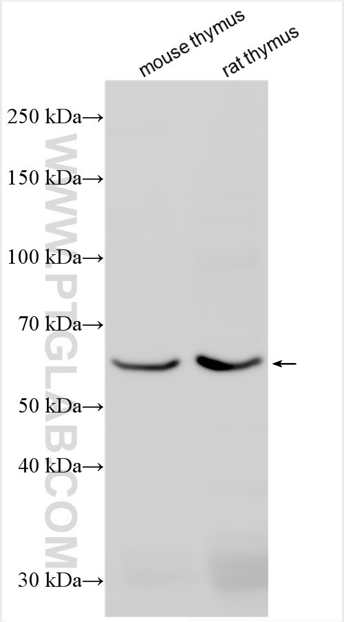 Western Blot (WB) analysis of various lysates using SLC15A3 Polyclonal antibody (20866-1-AP)