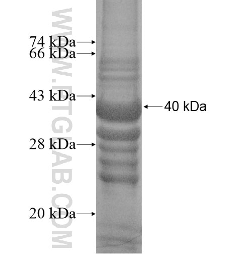 SLC15A3 fusion protein Ag14915 SDS-PAGE
