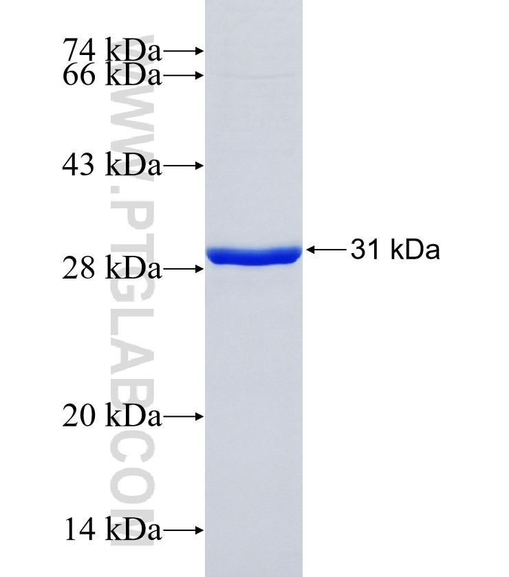 SLC15A5 fusion protein Ag34523 SDS-PAGE SLC15A5 fusion protein Ag34523 SDS-PAGE