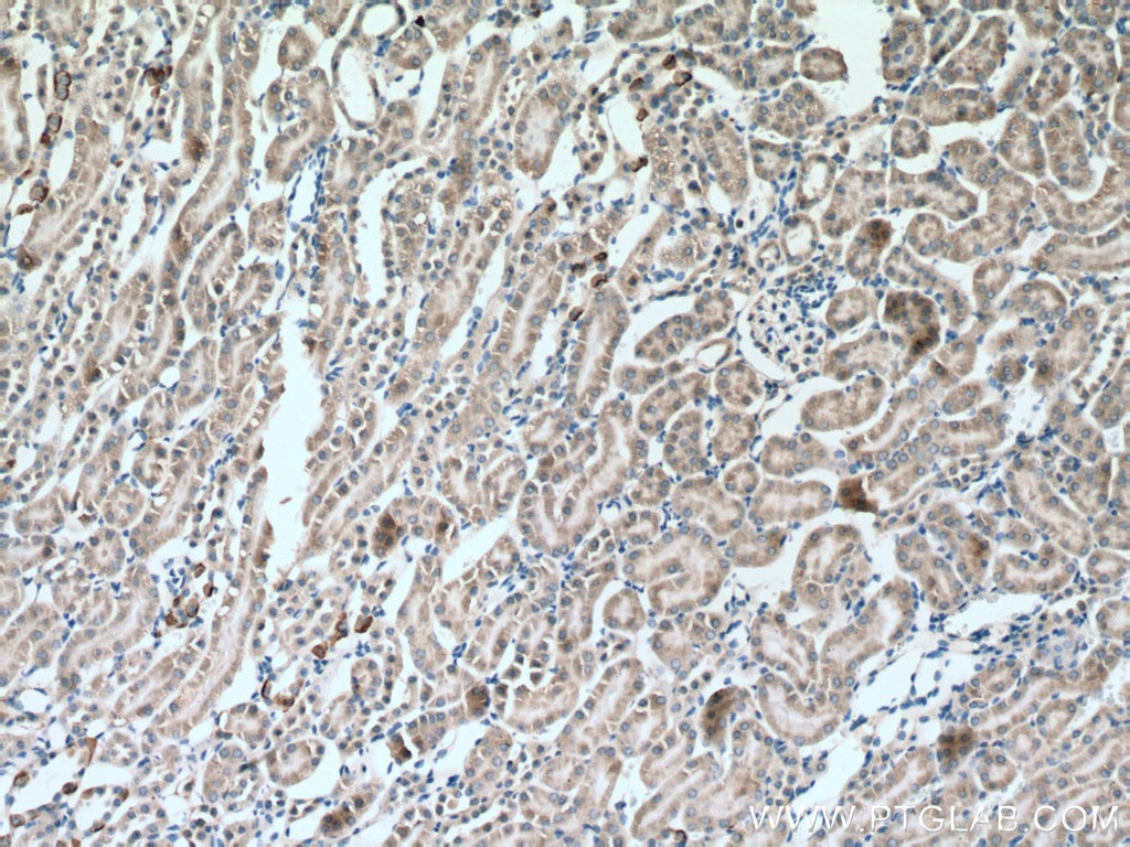 Immunohistochemistry (IHC) staining of mouse kidney tissue using SLC16A12 Polyclonal antibody (20553-1-AP)