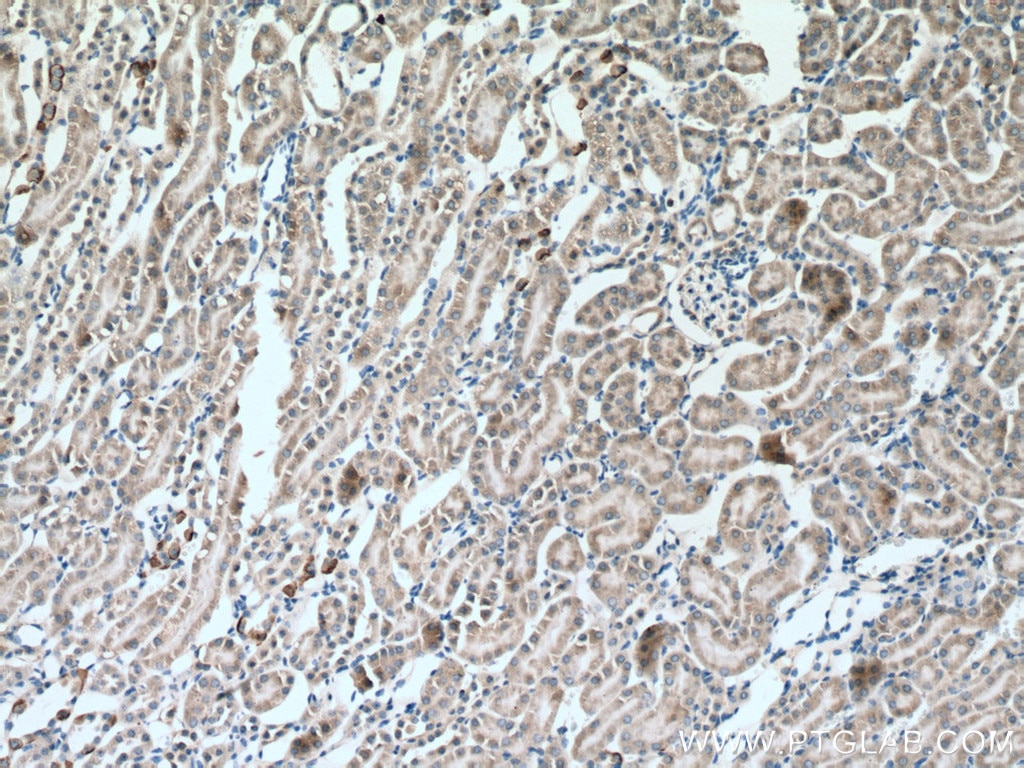 IHC staining of mouse kidney using 20553-1-AP