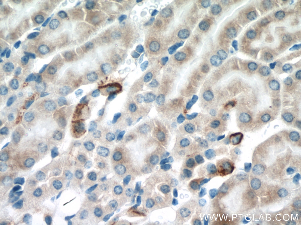 Immunohistochemistry (IHC) staining of mouse kidney tissue using SLC16A12 Polyclonal antibody (20553-1-AP)