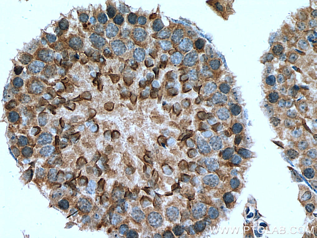 Immunohistochemistry (IHC) staining of mouse testis tissue using SLC16A12 Polyclonal antibody (20553-1-AP)