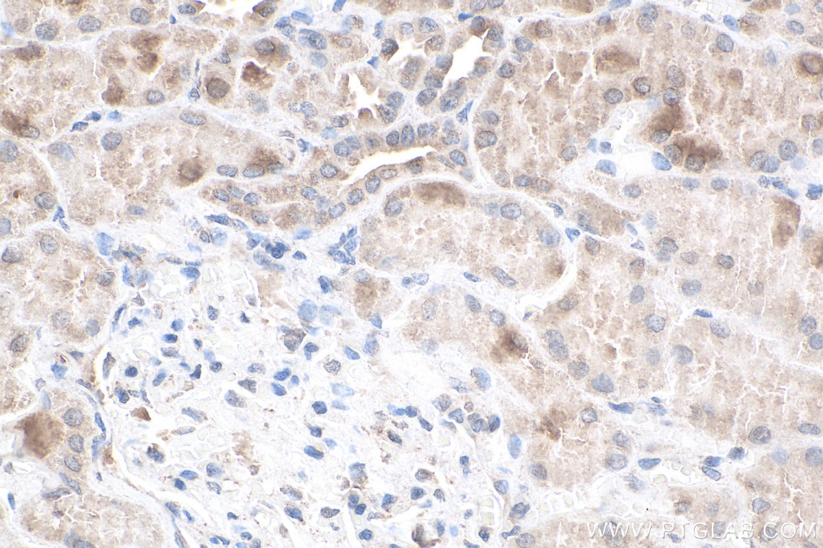 Immunohistochemistry (IHC) staining of human kidney tissue using SLC16A12 Polyclonal antibody (20553-1-AP)