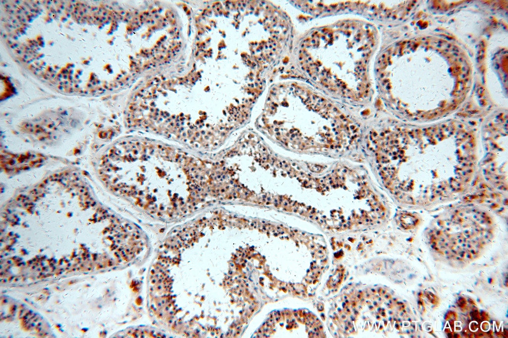 Immunohistochemistry (IHC) staining of human testis tissue using SLC16A12 Polyclonal antibody (20553-1-AP)